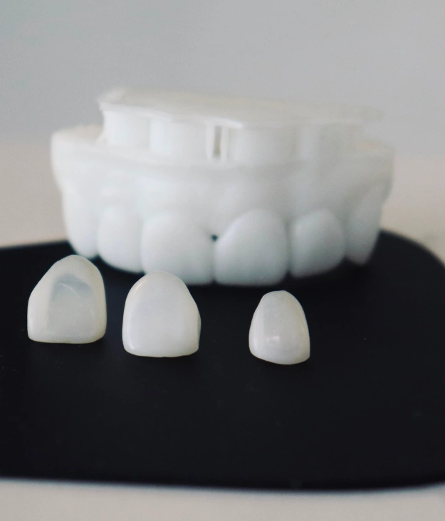 Dental veneers displayed as thin tooth coverings for improving the appearance of teeth