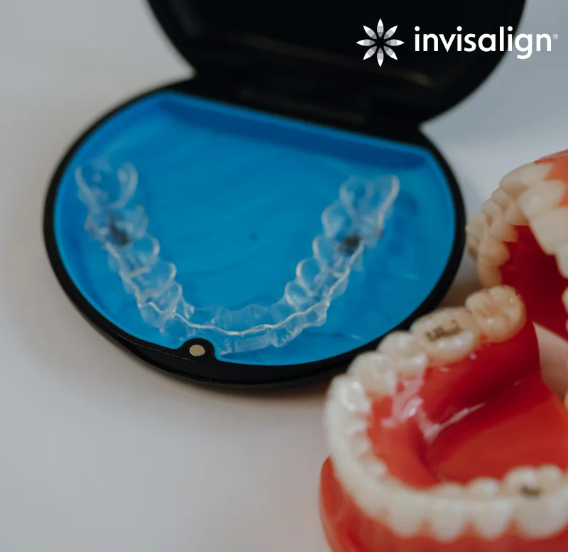 invisalign braces